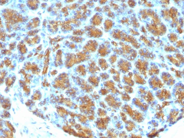 Formalin-fixed, paraffin-embedded human Pancreas stained with Milk Fat Globule Monoclonal Antibody (MFG-06)