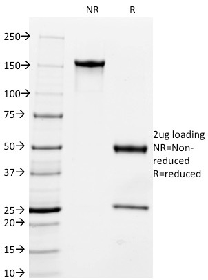 SDS-PAGE Analysis Purified Milk Fat Globule Monoclonal Antibody (MFG-06). Confirmation of Integrity and Purity of Antibody