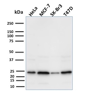 Western Blot Analysis of HeLa, MCF-7, Sk-Br3 & T47D cell lysates using Mouse Mammaglobin-Monospecific Monoclonal Antibody (MGB/2000).