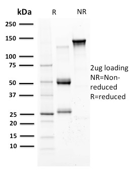SDS-PAGE Analysis of Purified Monospecific Mouse Monoclonal Antibody (SPM518) to Mammaglobin. Confirmation of purity and integrity. Mammaglobin (SCGB2A2) (Breast Cancer Marker) Antibody - Image 2