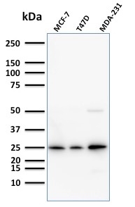 Western Blot Analysis of Human MCF-7,T47D and MDA-231 cell lysate using Monospecific Mouse Monoclonal Antibody (SPM518) to Mammaglobin. Mammaglobin (SCGB2A2) (Breast Cancer Marker) Antibody - Image 3