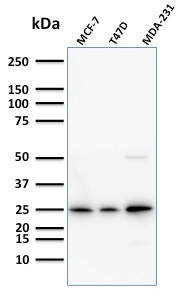 Western Blot Analysis of Human MCF-7,T47D and MDA-231 cell lysate using Monospecific Mouse Monoclonal Antibody (SPM518) to Mammaglobin.