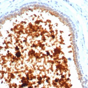 Formalin-fixed, paraffin-embedded human lactating breast stained with Mammaglobin Recombinant Rabbit Monoclonal Antibody (MGB/4811R).