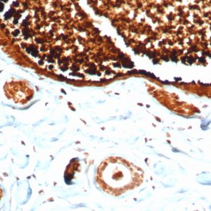 Formalin-fixed, paraffin-embedded human lactating breast stained with Mammaglobin Recombinant Rabbit Monoclonal Antibody (MGB/4812R).