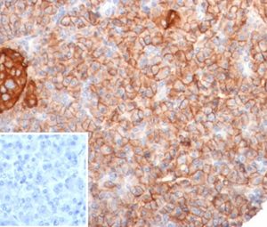 Formalin-fixed, paraffin-embedded human pancreas stained with  CD99 Mouse Monoclonal Antibody (MIC2/7310). Inset: PBS instead of primary antibody; secondary only negative control.