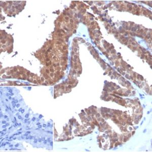 Formalin-fixed, paraffin-embedded humanprostate stained with MIF Mouse Monoclonal Antibody (MIF/3488). Inset: PBS instead of primary antibody; secondary only negative control.