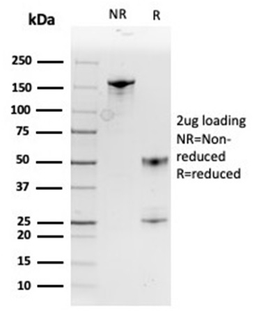 SDS-PAGE Analysis Purified MIF Mouse Monoclonal Antibody (MIF/3488). Confirmation of Purity and Integrity of Antibody.