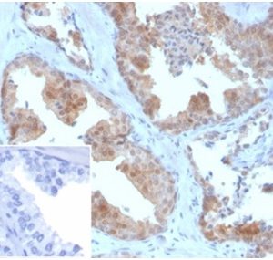 Formalin-fixed, paraffin-embedded humanprostate stained with MIF Mouse Monoclonal Antibody (MIF/3490). Inset: PBS instead of primary antibody; secondary only negative control.