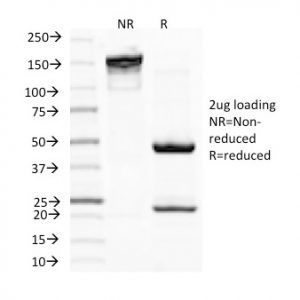 SDS-PAGE Analysis of Purified MITF Mouse Monoclonal Antibody (C5/D5). Confirmation of Integrity and Purity of Antibody.