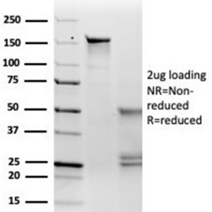 SDS-PAGE Analysis of Purified MITF Mouse Monoclonal Antibody (PCRP-MITF-1D9). Confirmation of Integrity and Purity of Antibody.