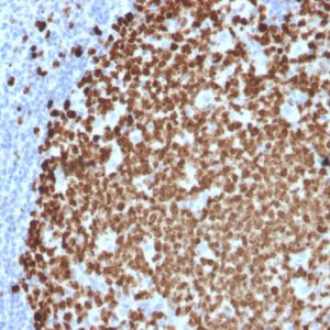 Formalin-fixed, paraffin-embedded human tonsil stained with Ki67 Mouse Monoclonal Antibody (MKI67/2461).