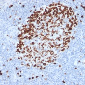 Formalin-fixed, paraffin-embedded human tonsil stained with Ki67-Monospecific Mouse Monoclonal Antibody (MKI67/2462).