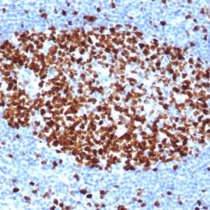 Formalin-fixed, paraffin-embedded human tonsil stained with Ki67 Recombinant Mouse Monoclonal Antibody (rMKI67/6499).