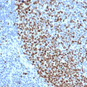 Formalin-fixed, paraffin-embedded human tonsil stained with Ki67 Recombinant Mouse Monoclonal Antibody (rMKI67/6615).