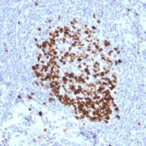 Formalin-fixed, paraffin-embedded human Tonsil stained with Ki67 Mouse Monoclonal Antibody (MKI67/2466).