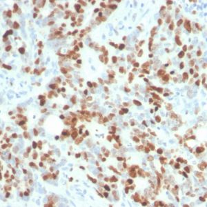 Formalin-fixed, paraffin-embedded human lymph node stained with Ki67 Recombinant Rabbit Monoclonal Antibody (MKI67/4945R).