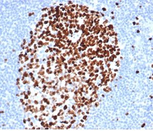 Formalin-fixed, paraffin-embedded human tonsil stained with Ki67 Recombinant Rabbit Monoclonal Antibody (MKI67/4947R).