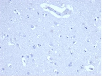 IHC analysis of formalin-fixed, paraffin-embedded human brain. Negative tissue control using MKI67/4947R at 2ug/ml in PBS for 30min RT. HIER: Tris/EDTA, pH9.0, 45min. 2 °: HRP-polymer, 30min. DAB, 5min.