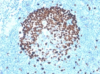 Formalin-fixed, paraffin-embedded human tonsil stained with Ki67 Recombinant Rabbit Monoclonal Antibody (MKI67/4947R).