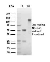 SDS-PAGE Analysis Purified Ki67 Recombinant Rabbit Monoclonal Antibody (MKI67/4947R). Confirmation of Integrity and Purity of Antibody.