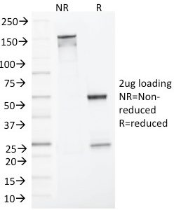 SDS-PAGE Analysis Purified MLH1 Mouse Monoclonal Antibody (MLH1/1324). Confirmation of Integrity and Purity of Antibody
