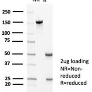 SDS-PAGE Analysis Purified MLH1 Mouse Monoclonal Antibody (MLH1/6710). Confirmation of Integrity and Purity of Antibody.