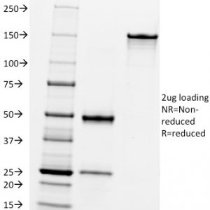 SDS-PAGE Analysis Purified CD10 Mouse Monoclonal Antibody (FR4D11). Confirmation of Integrity and Purity of Antibody