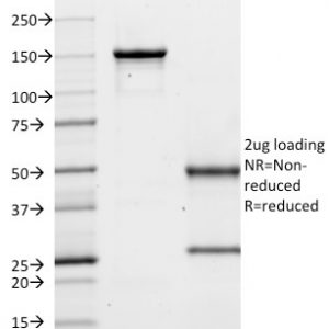 SDS-PAGE Analysis Purified CD10 Mouse Monoclonal Antibody (MME/1620). Confirmation of Purity and Integrity of Antibody.