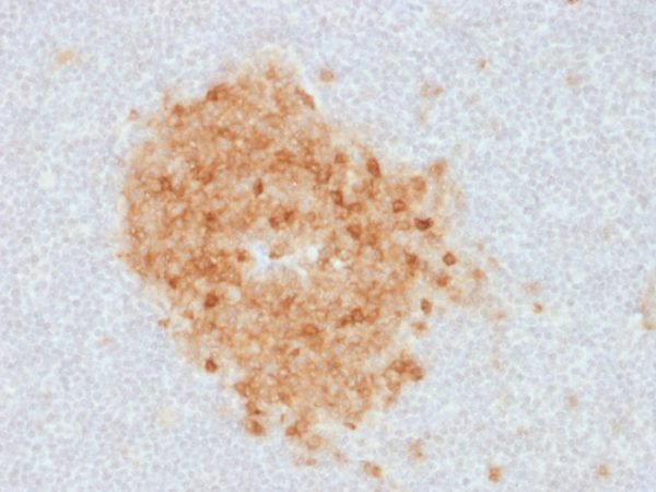 Formalin-fixed, paraffin-embedded human Tonsil stained with CD10 Mouse Monoclonal Antibody (MME/1893).