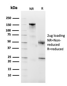 SDS-PAGE Analysis Purified CD10 Mouse Monoclonal Antibody (MME/2590). Confirmation of Purity and Integrity of Antibody.