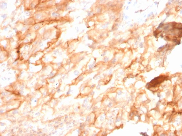 Formalin-fixed, paraffin-embedded human Kidney stained with CD10 Mouse Monoclonal Antibody (MME/2590).