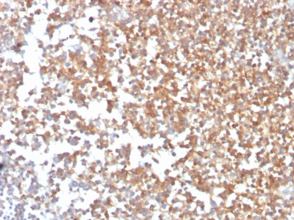 Formalin-fixed, paraffin-embedded human kidney stained with CD10 Mouse Monoclonal Antibody (MME/3739).