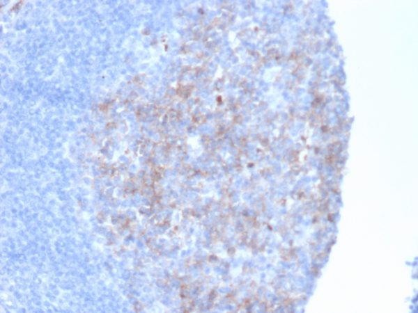Formalin-fixed, paraffin-embedded human kidney stained with CD10 Mouse Monoclonal Antibody (MME/6461).