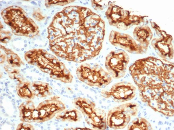 Formalin-fixed, paraffin-embedded human kidney stained with CD10 Recombinant Rabbit Monoclonal Antibody (MME/6696R). HIER: Tris/EDTA, pH9.0, 45min. 2 °: HRP-polymer, 30min. DAB, 5min.