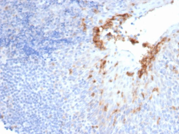 Formalin-fixed, paraffin-embedded human prostate stained with CD10 Recombinant Rabbit Monoclonal Antibody (MME/6696R). HIER: Tris/EDTA, pH9.0, 45min. 2 °: HRP-polymer, 30min. DAB, 5min.