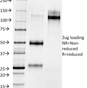 SDS-PAGE Analysis of Purified MMP3 Mouse Monoclonal Antibody (1B4). Confirmation of Integrity and Purity of Antibody.