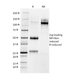 SDS-PAGE Analysis of Purified MMP3 Mouse Monoclonal Antibody (MMP3/1730). Confirmation of Purity and Integrity of Antibody.