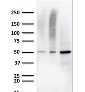 Western Blot Analysis of Human Raji, HEK293, and HT-29 cell lysate using MMP3 Mouse Monoclonal Antibody (MMP3/2655).