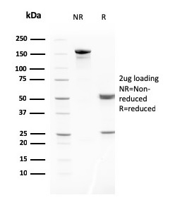 SDS-PAGE Analysis of Purified MMP3 Mouse Monoclonal Antibody (MMP3/2806). Confirmation of Purity and Integrity of Antibody.
