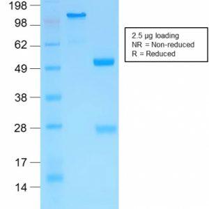 SDS-PAGE Analysis of Purified MMP3 Rabbit Recombinant Monoclonal Antibody (MMP3/1994R).