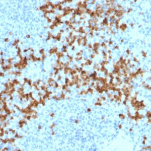 Formalin-fixed, paraffin-embedded human Spleen stained with MMP9 Mouse Monoclonal Antibody (2C3).