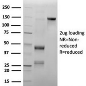 SDS-PAGE Analysis of Purified MPO Recombinant Mouse Monoclonal Antibody (rMPO/6904). Confirmation of Integrity and Purity of Antibody.