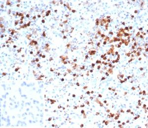 Formalin-fixed, paraffin-embedded human spleen stained with Myeloperoxidase Mouse Monoclonal Antibody (MPO/7116). Inset: PBS instead of primary antibody; secondary only negative control.