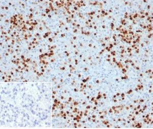 Formalin-fixed, paraffin-embedded human spleen stained with Myeloperoxidase Recombinant Rabbit Monoclonal Antibody (MPO/33R). Inset: PBS instead of primary, secondary antibody negative control.