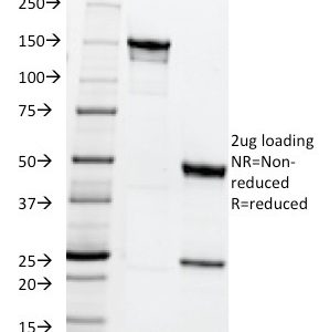 SDS-PAGE Analysis of Purified MRP1 Mouse Monoclonal Antibody (MRP1/1344). Confirmation of Integrity and Purity of Antibody.