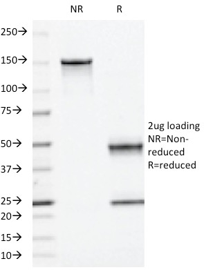 SDS-PAGE Analysis Purified Moesin Mouse Monoclonal Antibody (MSN/493). Confirmation of Integrity and Purity of Antibody