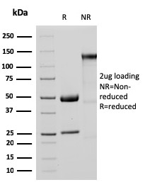 SDS-PAGE Analysis Purified MTAP Recombinant Rabbit Monoclonal Antibody (MTAP/3137R). Confirmation of Purity and Integrity of Antibody.