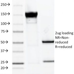 SDS-PAGE Analysis of Purified MUC1 Mouse Monoclonal Antibody (VU-2G7). Confirmation of Integrity and Purity of Antibody.