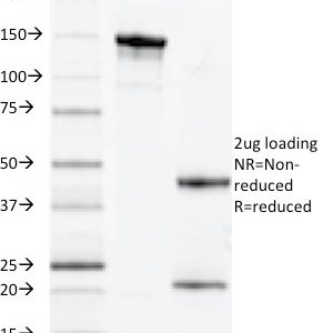 SDS-PAGE Analysis of Purified MUC1 Mouse Monoclonal Antibody (VU-11D1). Confirmation of Integrity and Purity of Antibody.