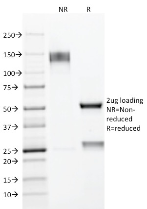SDS-PAGE Analysis of Purified MUC-1 / EMA Mouse Monoclonal Antibody (E29). Confirmation of Integrity and Purity of Antibody